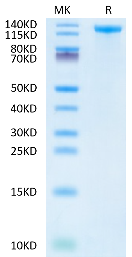 Human Jagged 1 on Tris-Bis PAGE under reduced condition. The purity is greater than 95%.