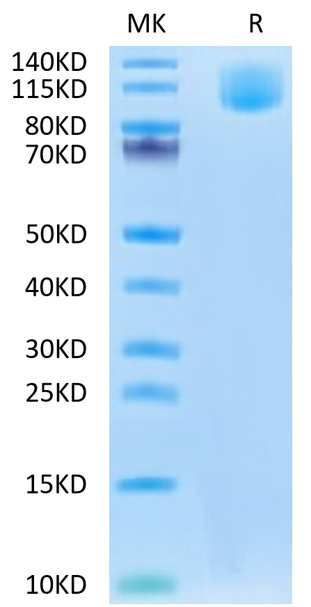 Human CA125 on Tris-Bis PAGE under reduced condition. The purity is greater than 95%.