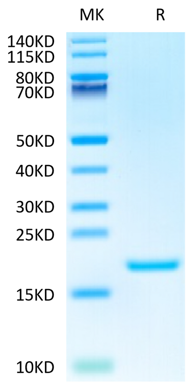 Human IL-3 on Tris-Bis PAGE under reduced condition. The purity is greater than 95%.