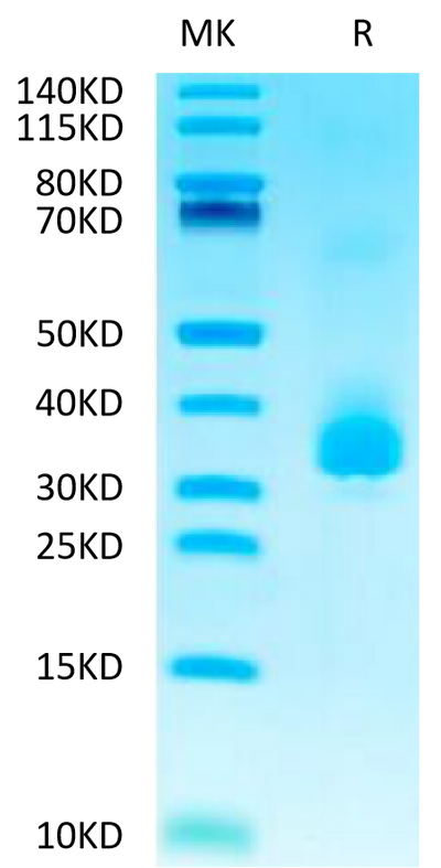 Biotinylated Human ANGPTL3 on Tris-Bis PAGE under reduced conditions. The purity is greater than 95%.