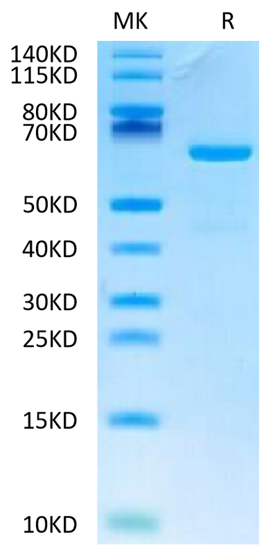 Human CD73 on Tris-Bis PAGE under reduced condition. The purity is greater than 95%.