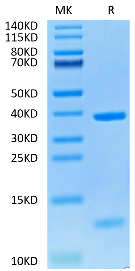 Human HLA-A*02:01&B2M&NY-ESO-1 (SLLMWITQC) Monomer on Tris-Bis PAGE under reduced condition. The purity is greater than 95%.