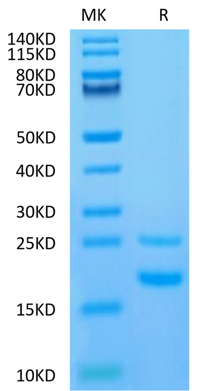 Human CCL5 on Tris-Bis PAGE under reduced condition. The purity is greater than 95%.