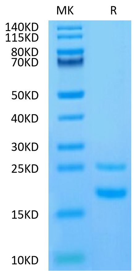 Human CCL5 on Tris-Bis PAGE under reduced condition. The purity is greater than 95%.