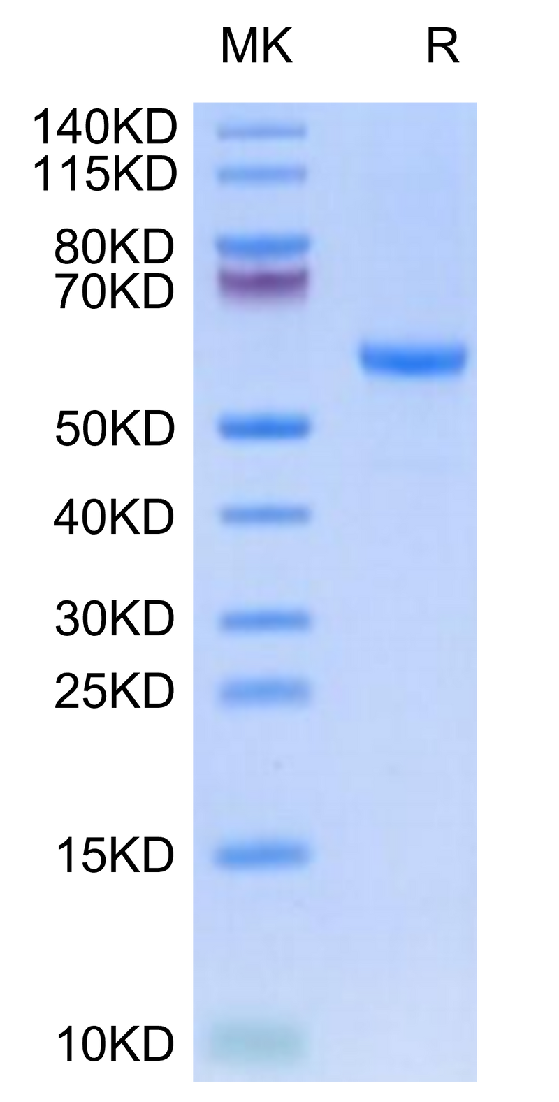 Rhesus macaque HLA-G&B2M&Peptide (RIIPRHLQL) Monomer on Tris-Bis PAGE under reduced condition. The purity is greater than 95%.