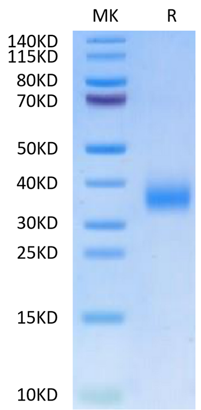 Human CD72 on Tris-Bis PAGE under reduced condition. The purity is greater than 95%.