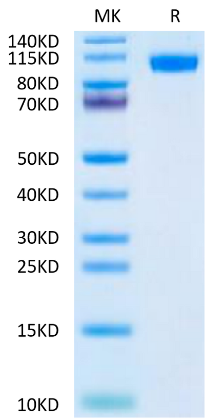 Mouse NCAM-1 on Tris-Bis PAGE under reduced condition. The purity is greater than 95%.