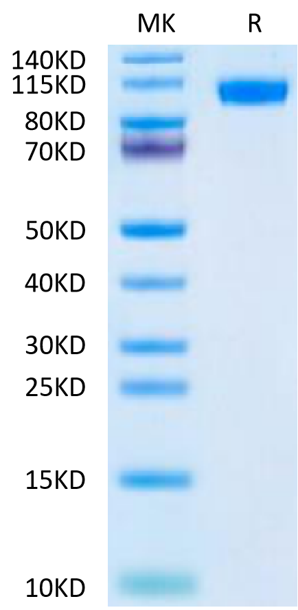 Mouse NCAM-1 on Tris-Bis PAGE under reduced condition. The purity is greater than 95%.