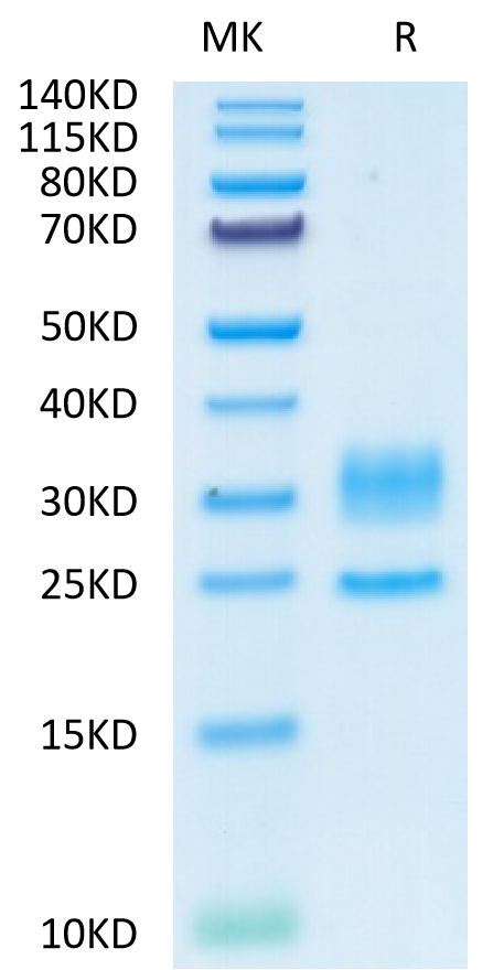 Human CD3E&CD3D on Tris-Bis PAGE under reduced condition. The purity is greater than 95%.