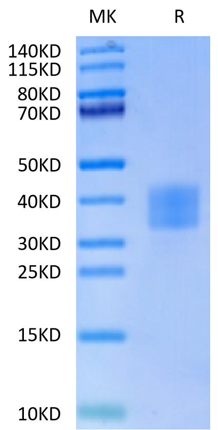 Human CD7 on Tris-Bis PAGE under reduced condition. The purity is greater than 95%.