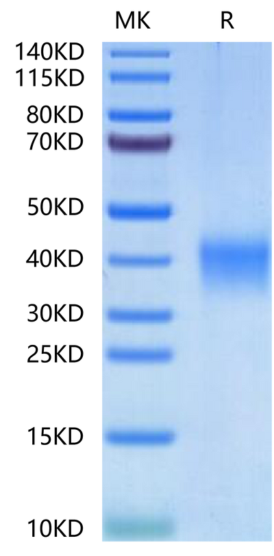 Human EPO on Tris-Bis PAGE under reduced condition. The purity is greater than 95%.