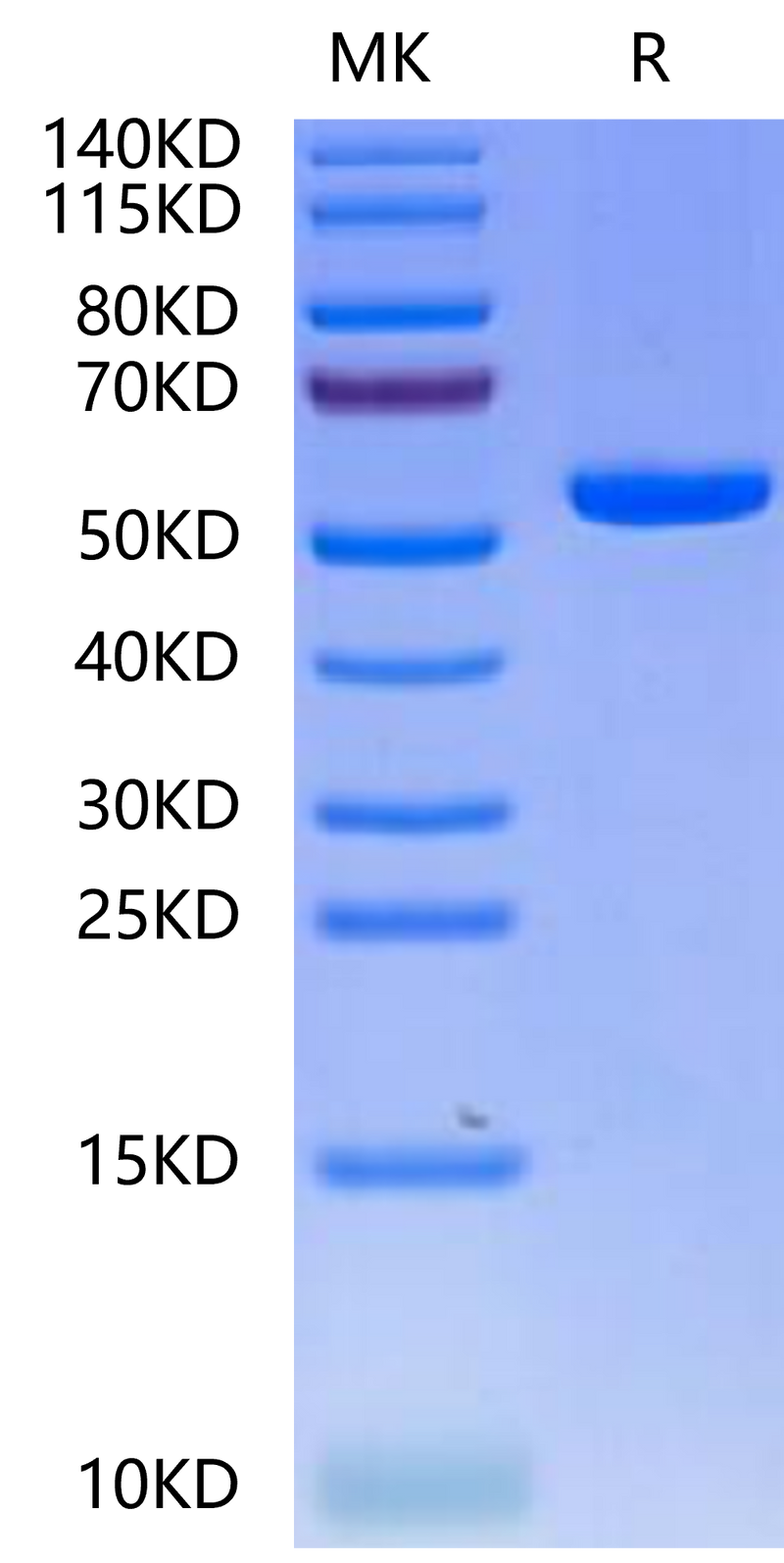 Biotinylated Human HLA-A*02:01&B2M&PRAME (SLLQHLIGL) Monomer on Tris-Bis PAGE under reduced condition. The purity is greater than 95%.