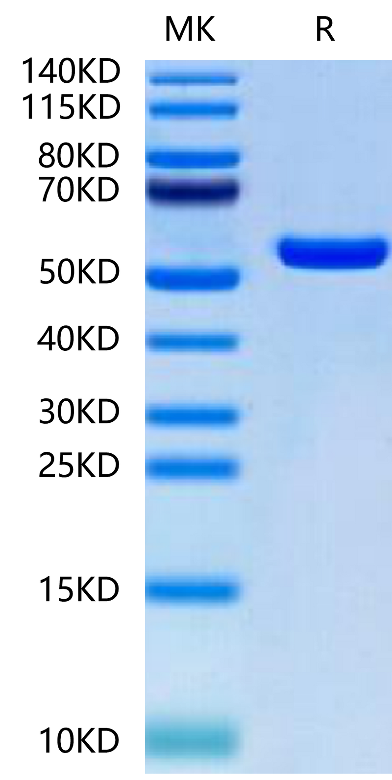 Biotinylated Human HLA-A*02:01&B2M&MAGE-A1 (KVLEYVIKV) Monomer on Tris-Bis PAGE under reduced condition. The purity is greater than 95%.