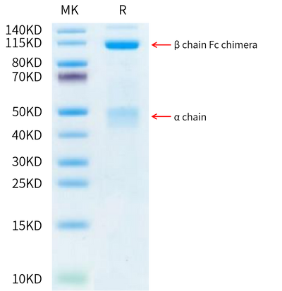 Human HGF R on Tris-Bis PAGE under reduced condition. The purity is greater than 95%.