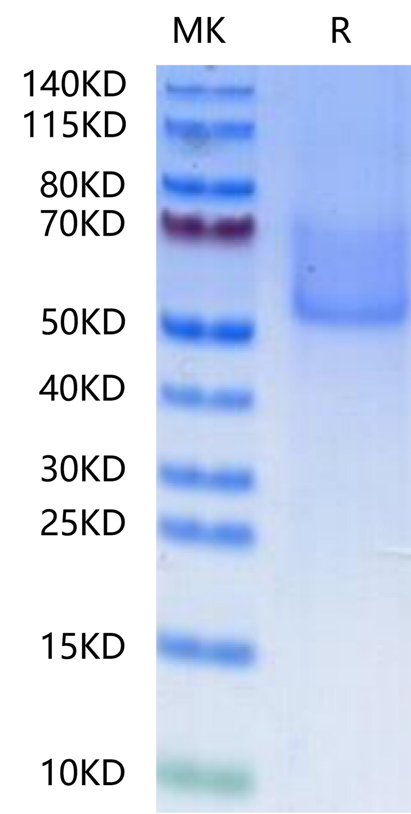 Cynomolgus Syndecan-1 on Tris-Bis PAGE under reduced condition. The purity is greater than 90%.