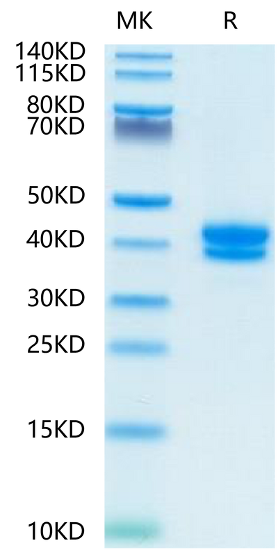 FITC-Compatible Human BCMA on Tris-Bis PAGE under reduced condition. The purity is greater than 95%.