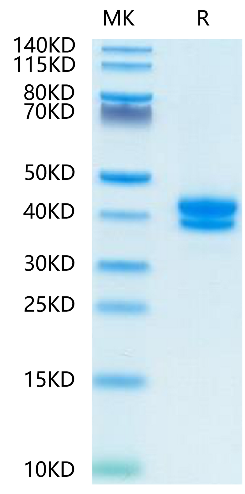 FITC-Compatible Human BCMA on Tris-Bis PAGE under reduced condition. The purity is greater than 95%.