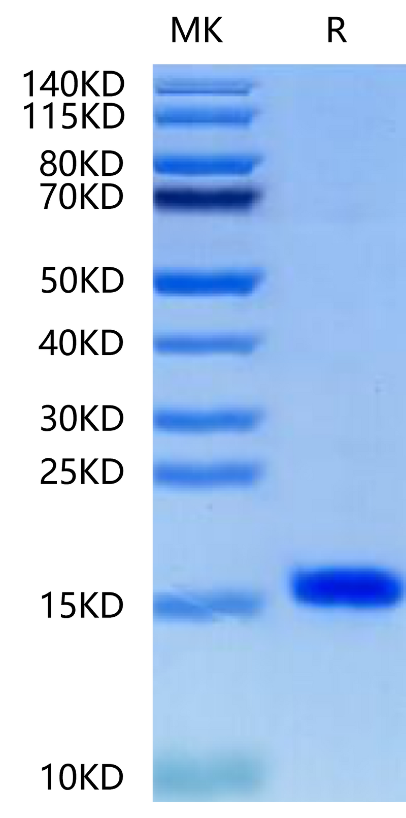 Human/Murine/Rat BDNF on Tris-Bis PAGE under reduced condition. The purity is greater than 95%.