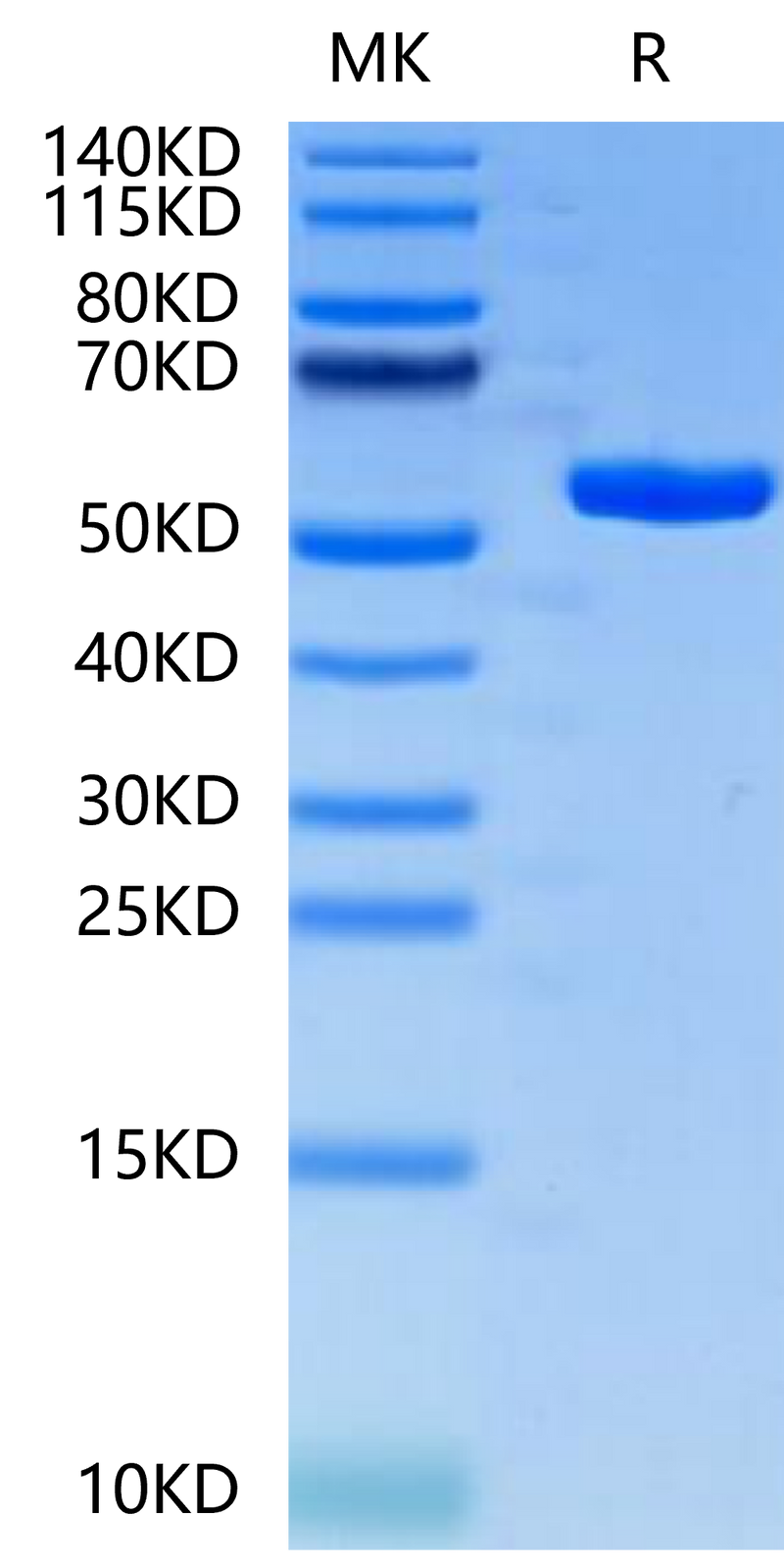 Human HLA-A*02:01&B2M&PRAME (ALYVDSLFFL) Monomer on Tris-Bis PAGE under reduced condition. The purity is greater than 95%.