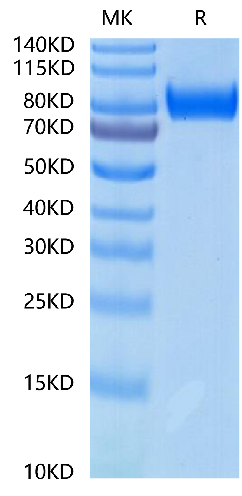 Rhesus macaque gp130 on Tris-Bis PAGE under reduced condition. The purity is greater than 95%.