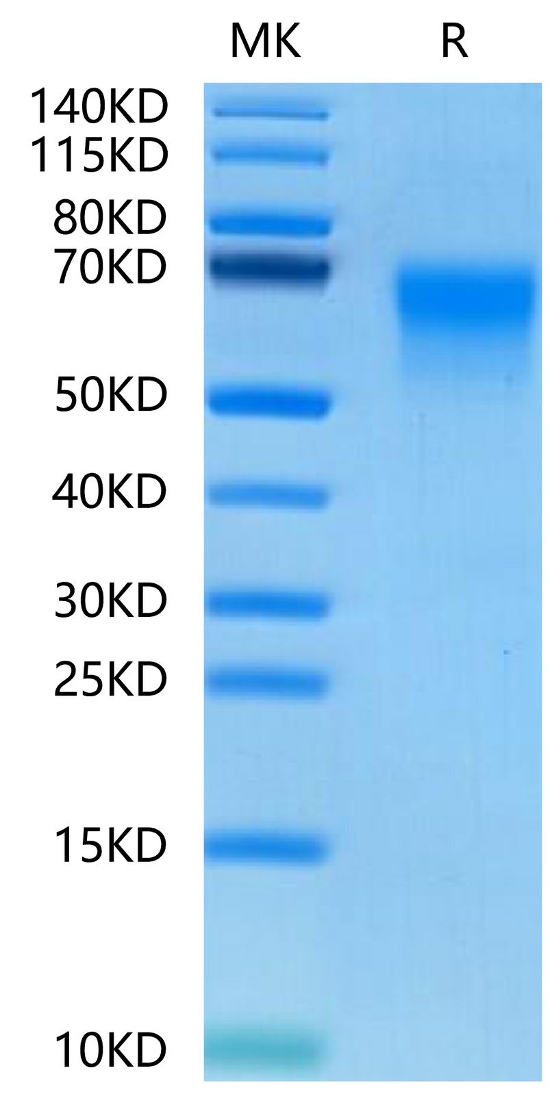 Human DKK3 on Tris-Bis PAGE under reduced conditions. The purity is greater than 95%.