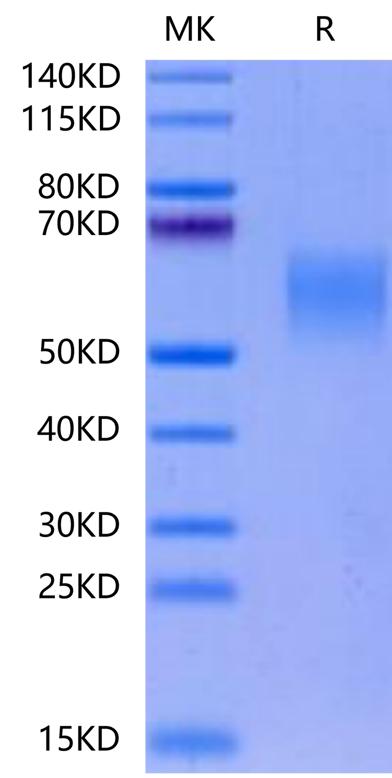 Cynomolgus GFRAL on Tris-Bis PAGE under reduced condition. The purity is greater than 95%.