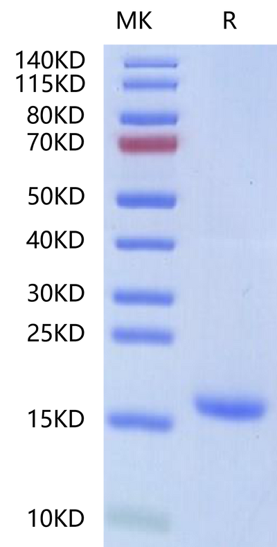 Human IL-18 on Tris-Bis PAGE under reduced condition. The purity is greater than 95%.