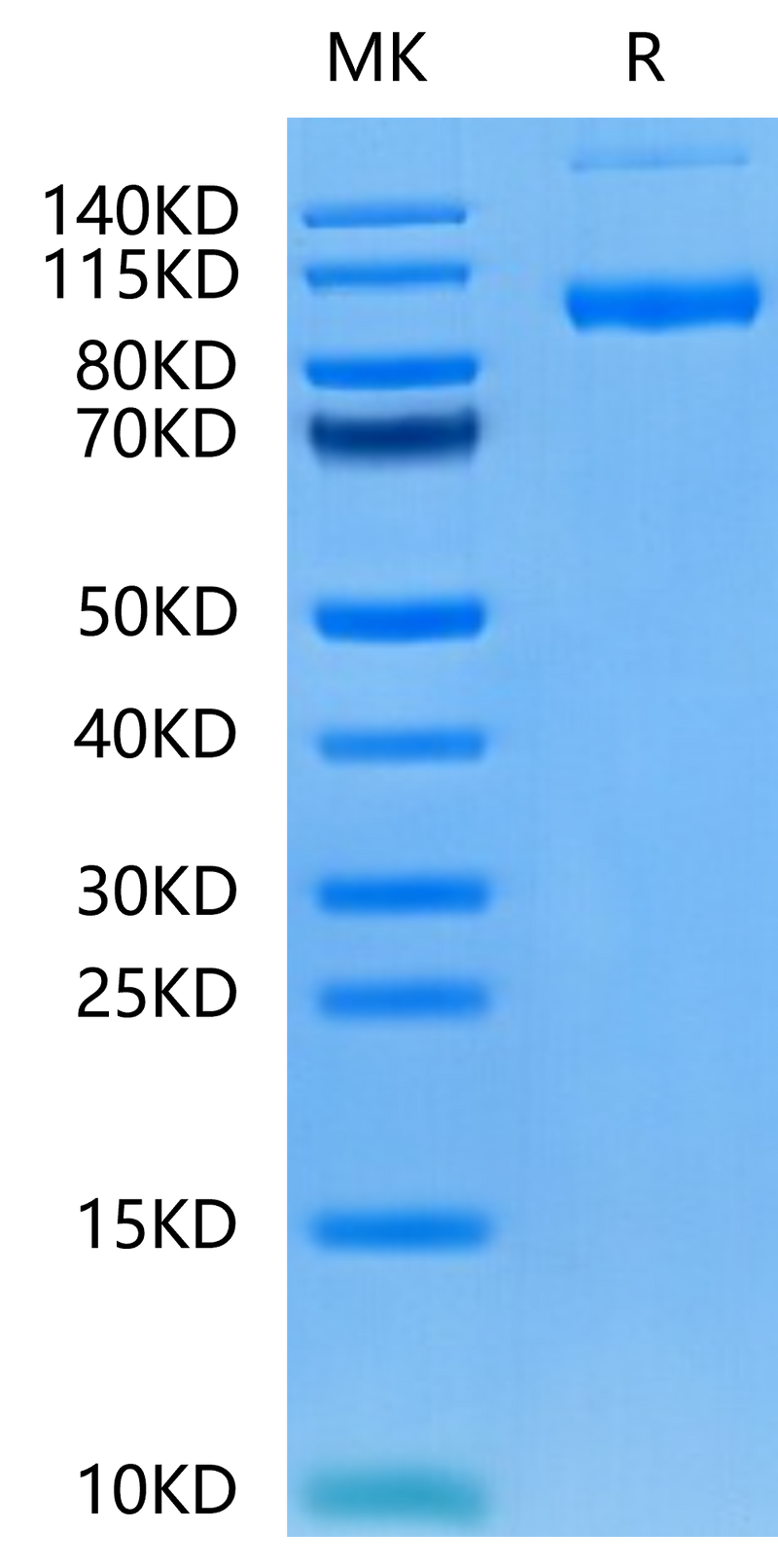 Human PSMA on Tris-Bis PAGE under reduced condition. The purity is greater than 95%.