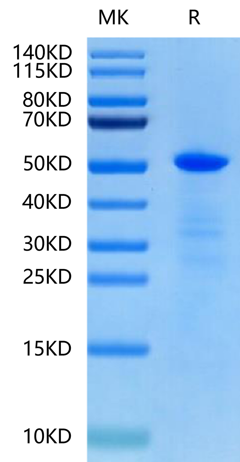 Human CHRDL1 on Tris-Bis PAGE under reduced condition. The purity is greater than 90%.