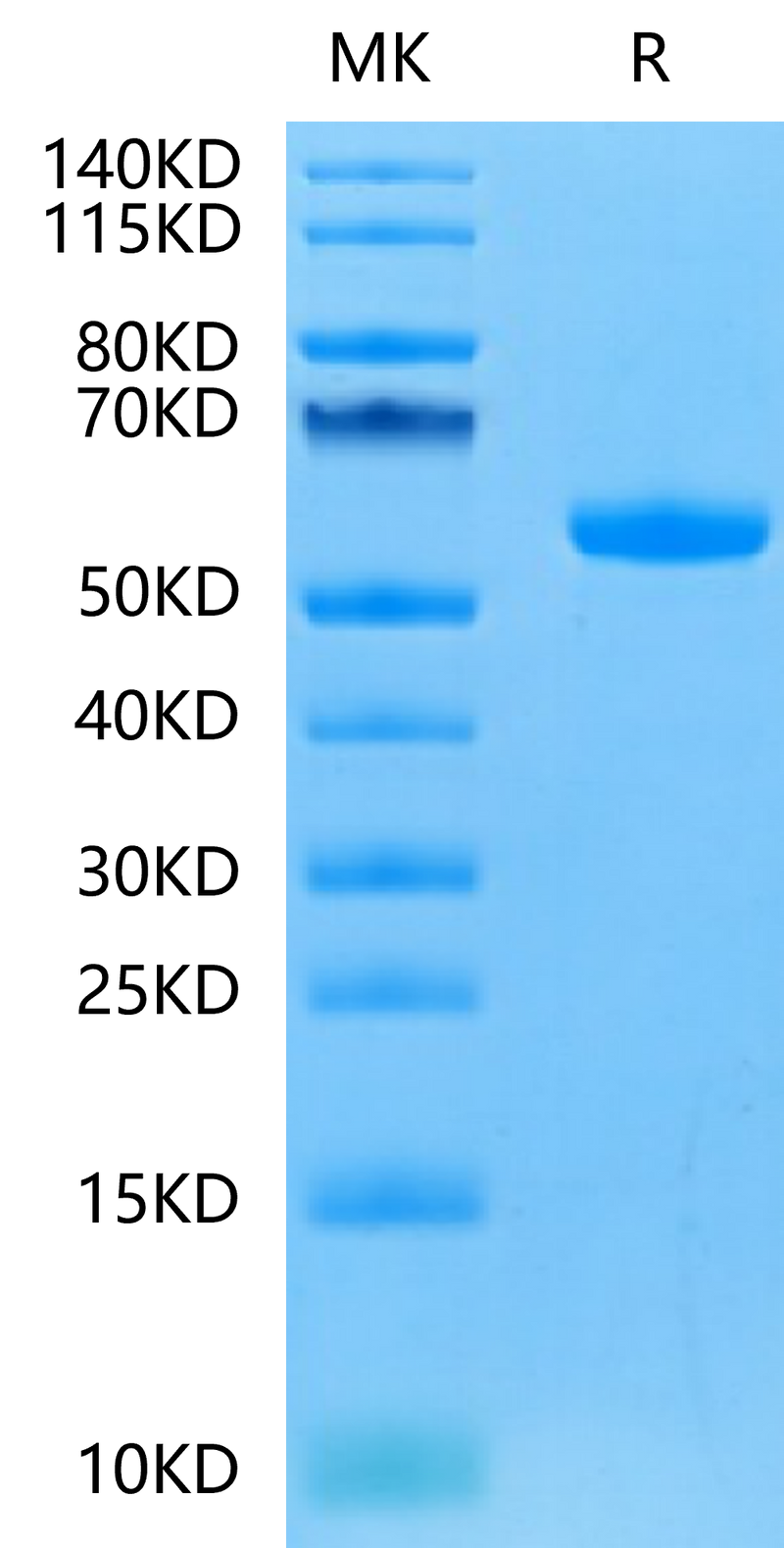 Human FGF21 on Tris-Bis PAGE under reduced condition. The purity is greater than 95%.