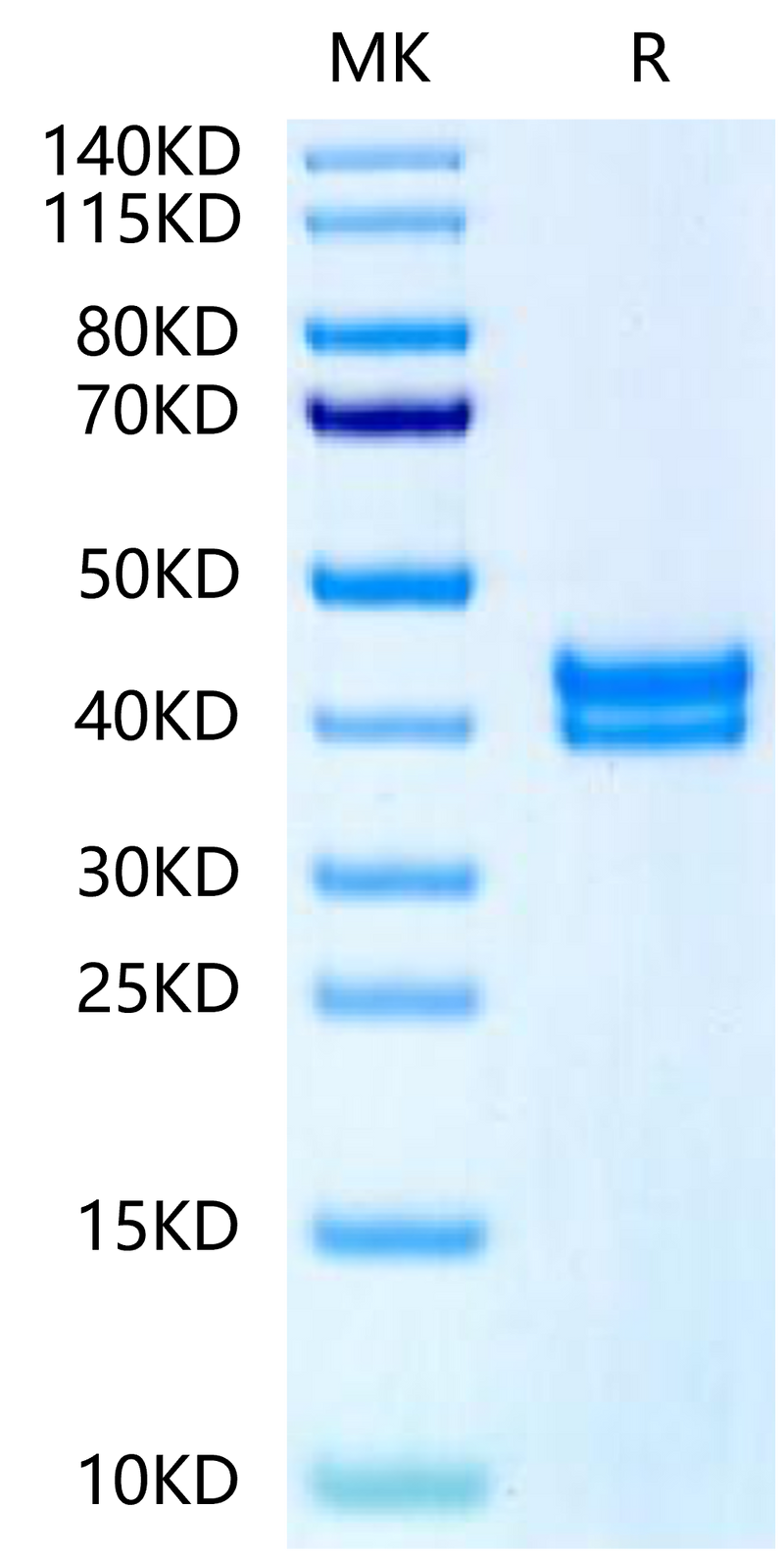 Biotinylated Human GPA33 on Tris-Bis PAGE under reduced condition. The purity is greater than 95%.