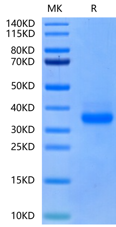 Canine CD40 on Tris-Bis PAGE under reduced condition. The purity is greater than 95%.