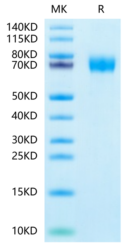 Human CLEC12A on Tris-Bis PAGE under reduced condition. The purity is greater than 95%.