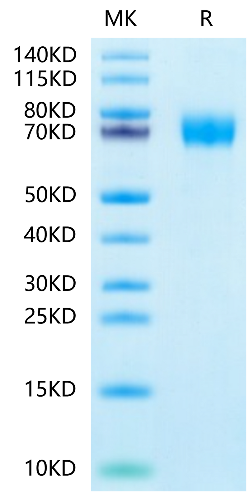 Human CLEC12A on Tris-Bis PAGE under reduced condition. The purity is greater than 95%.