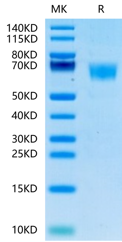 Human FGFR3 alpha (IIIc) on Tris-Bis PAGE under reduced conditions. The purity is greater than 95%.