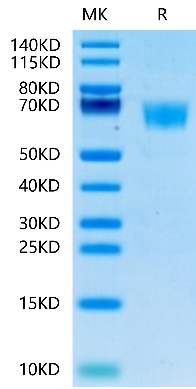 Human FGFR3 alpha (IIIc) on Tris-Bis PAGE under reduced conditions. The purity is greater than 95%.