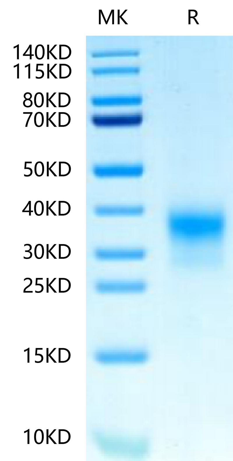 Biotinylated Human Her2 Domain 4 on Tris-Bis PAGE under reduced condition. The purity is greater than 95%.