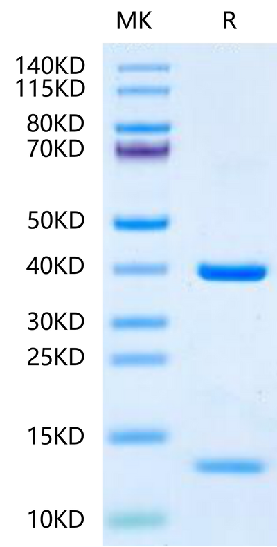 HLA-A*11:01&B2M&KRAS G12D (VVVGADGVGK) Monomer on Tris-Bis PAGE under reduced condition. The purity is greater than 95%.