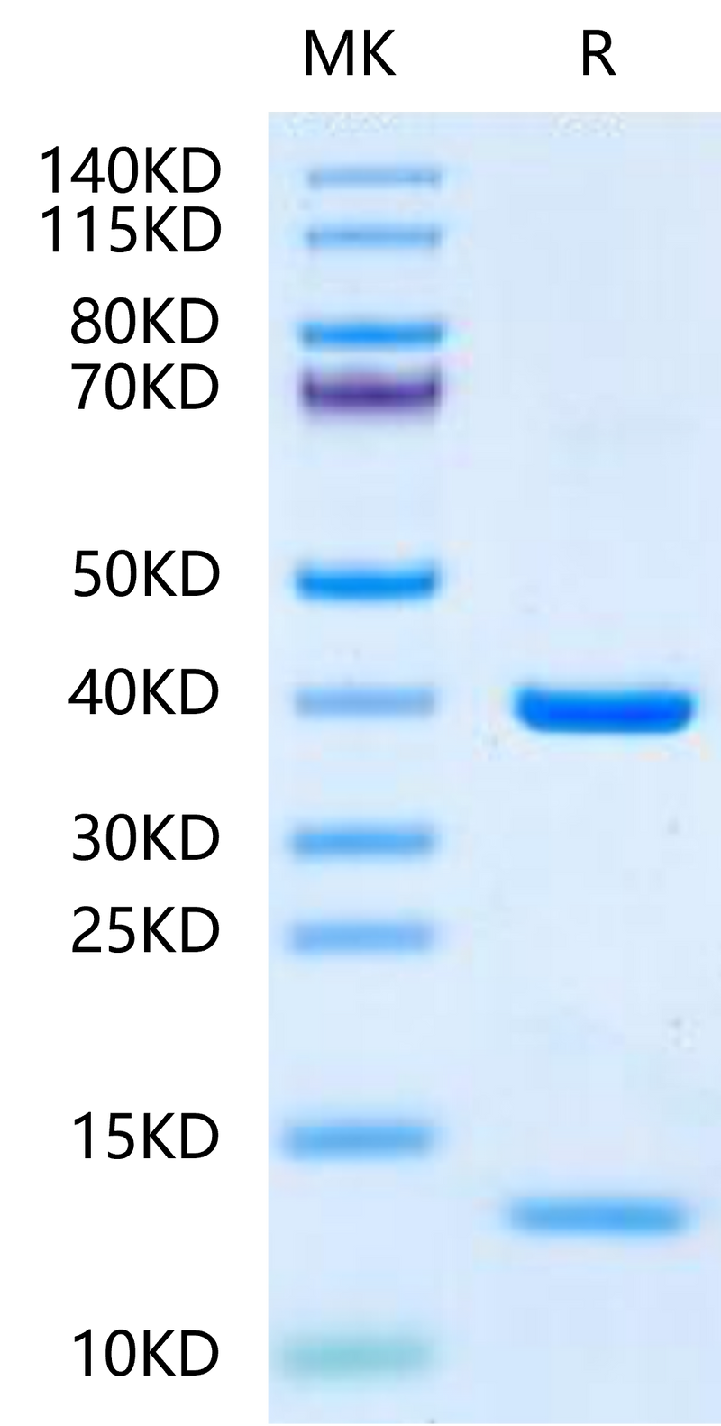 HLA-A*11:01&B2M&KRAS G12D (VVVGADGVGK) Monomer on Tris-Bis PAGE under reduced condition. The purity is greater than 95%.