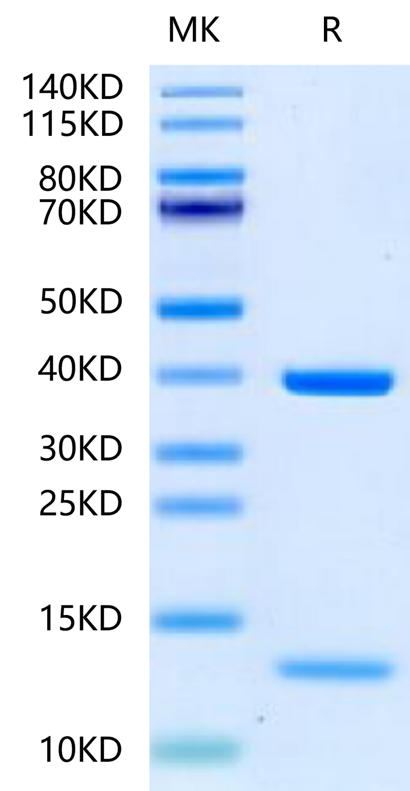 Biotinylated HLA-A*11:01&B2M&KRAS G12D (VVVGADGVGK) Monomer on Tris-Bis PAGE under reduced condition. The purity is greater than 95%.