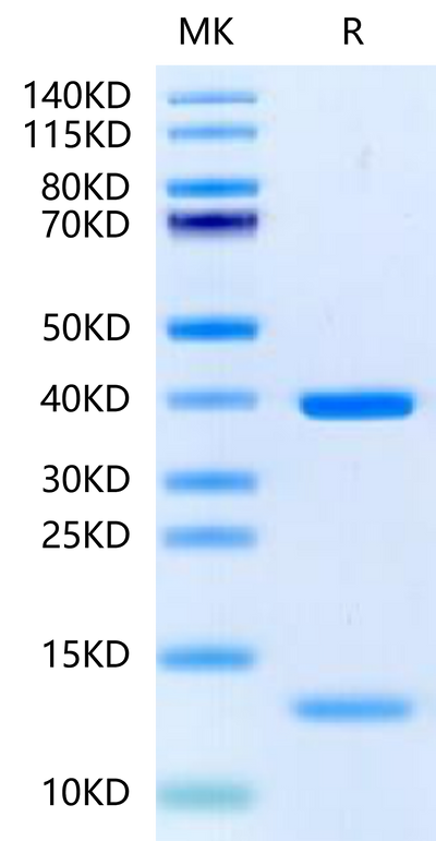 HLA-A*11:01&B2M&KRAS G12D (VVGADGVGK) Monomer on Tris-Bis PAGE under reduced condition. The purity is greater than 95%.