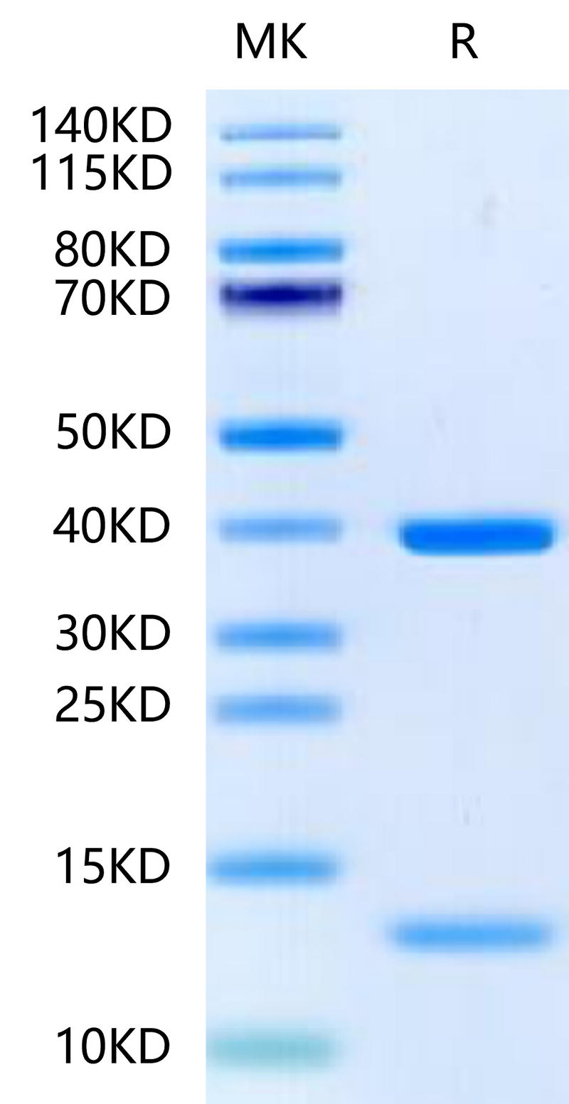 Biotinylated HLA-A*11:01&B2M&KRAS G12D (VVGADGVGK) Monomer on Tris-Bis PAGE under reduced condition. The purity is greater than 95%.