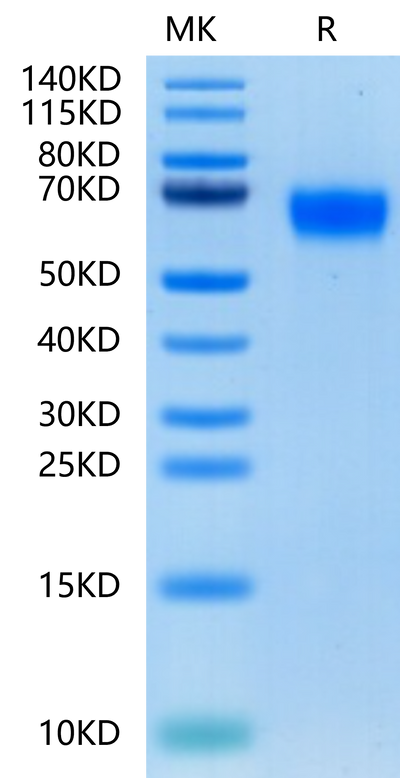 Human GM-CSF R alpha on Tris-Bis PAGE under reduced condition. The purity is greater than 95%.