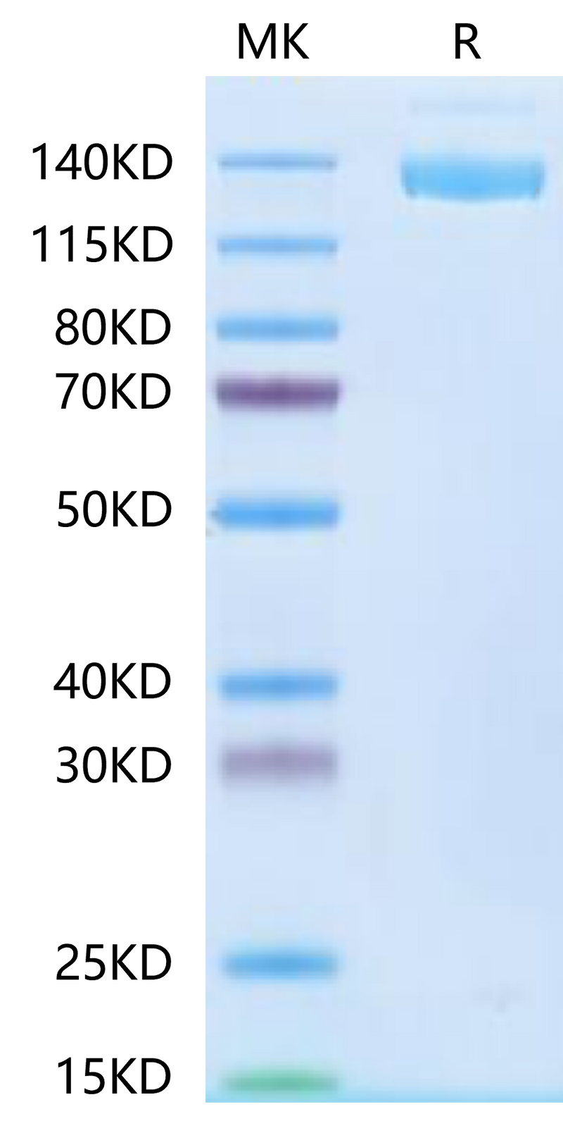 SARS-COV-2 Spike S Trimer on Tris-Bis PAGE under reduced condition. The purity is greater than 95%.