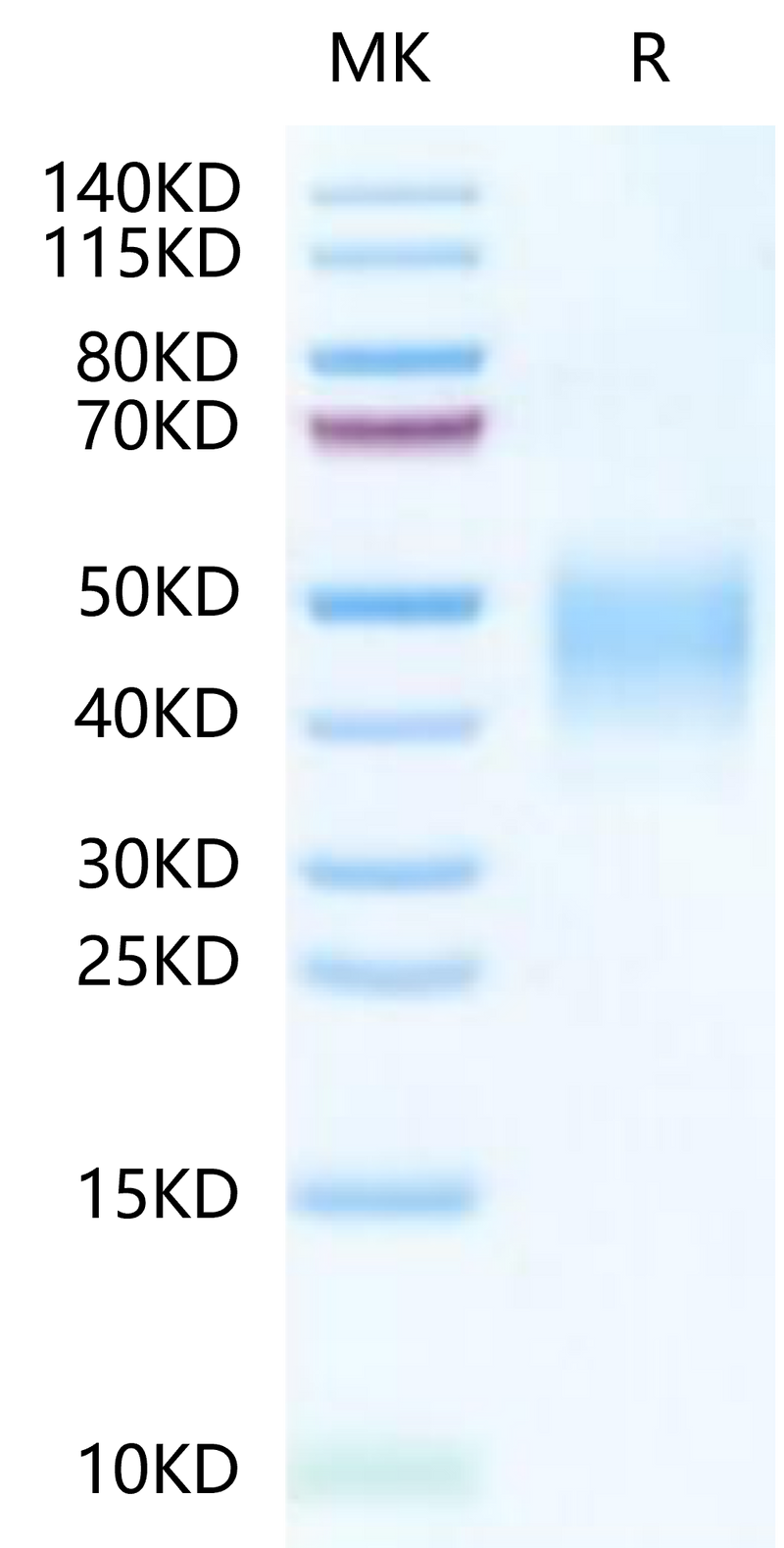 FITC-Labeled Human CLEC12A on Tris-Bis PAGE under reduced condition. The purity is greater than 95%.