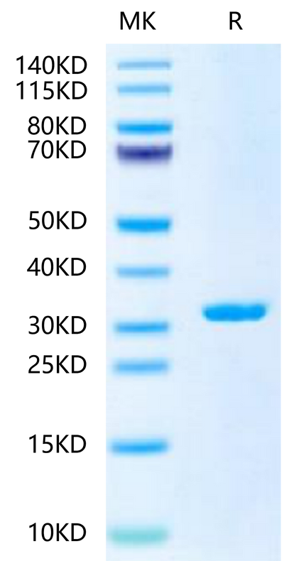 SARS-CoV-2 3CLpro (L50F, E166A, L167F) on Tris-Bis PAGE under reduced condition. The purity is greater than 95%.