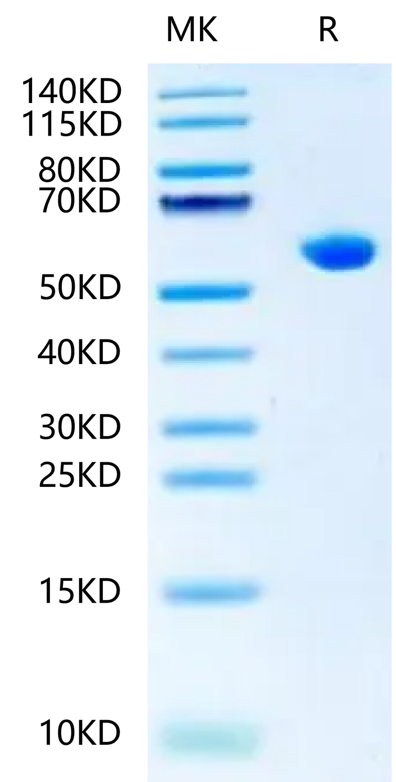 Biotinlylated Human HLA-B*15:01&B2M&SARS-CoV-2 epitope (NQKLIANQF) Monomer on Tris-Bis PAGE under reduced condition. The purity is greater than 95%.