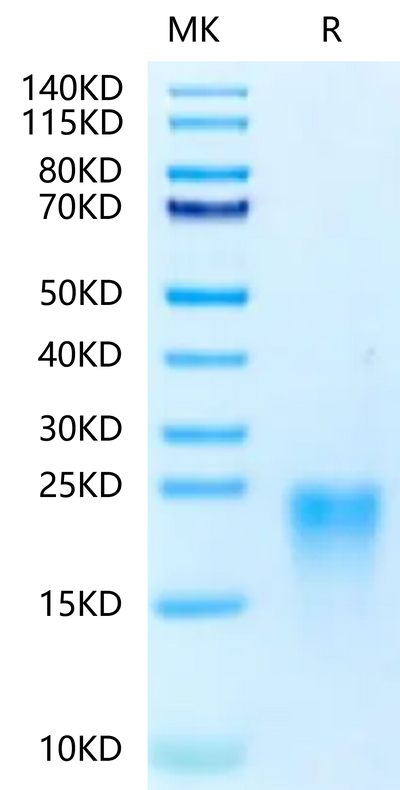 Human BAFFR on Tris-Bis PAGE under reduced conditions. The purity is greater than 95%.