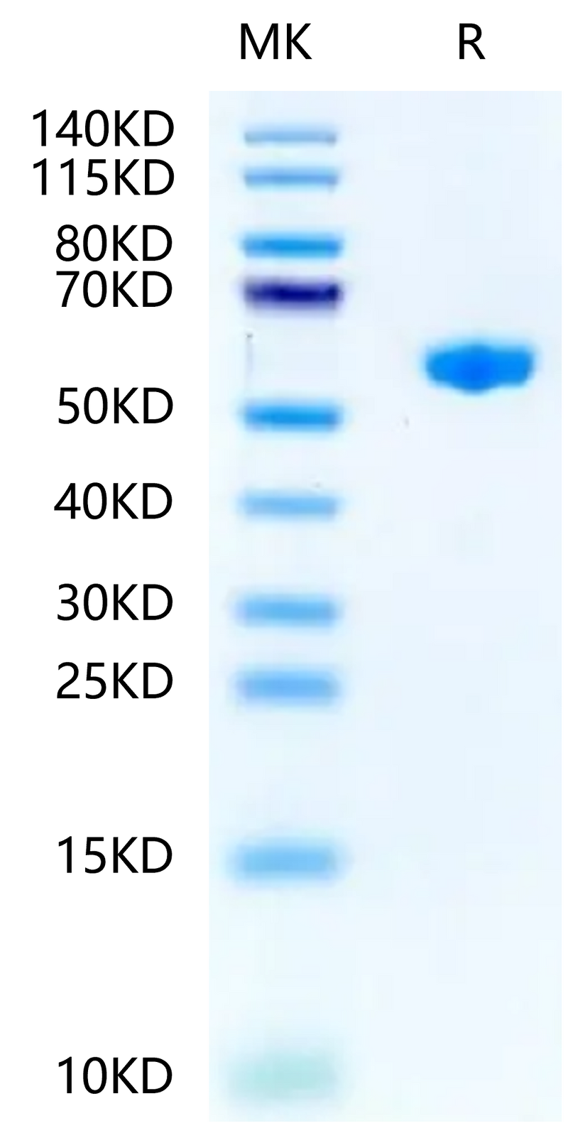 Mouse H-2K (b) &B2M&OVA (SIINFEKL) Monomer on Tris-Bis PAGE under reduced condition. The purity is greater than 95%.