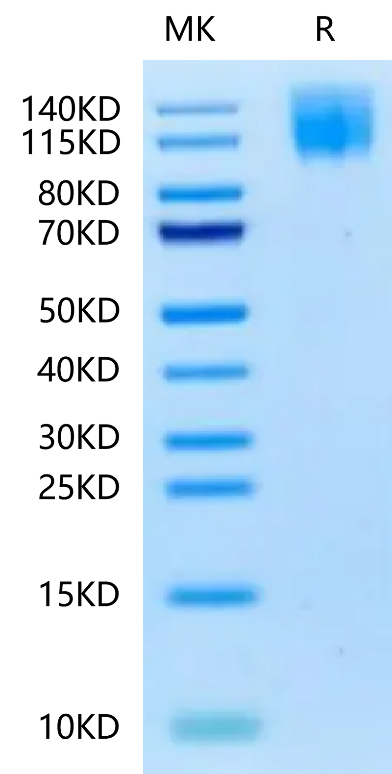 Biotinylated Human CEACAM-5 on Tris-Bis PAGE under reduced condition. The purity is greater than 95%.